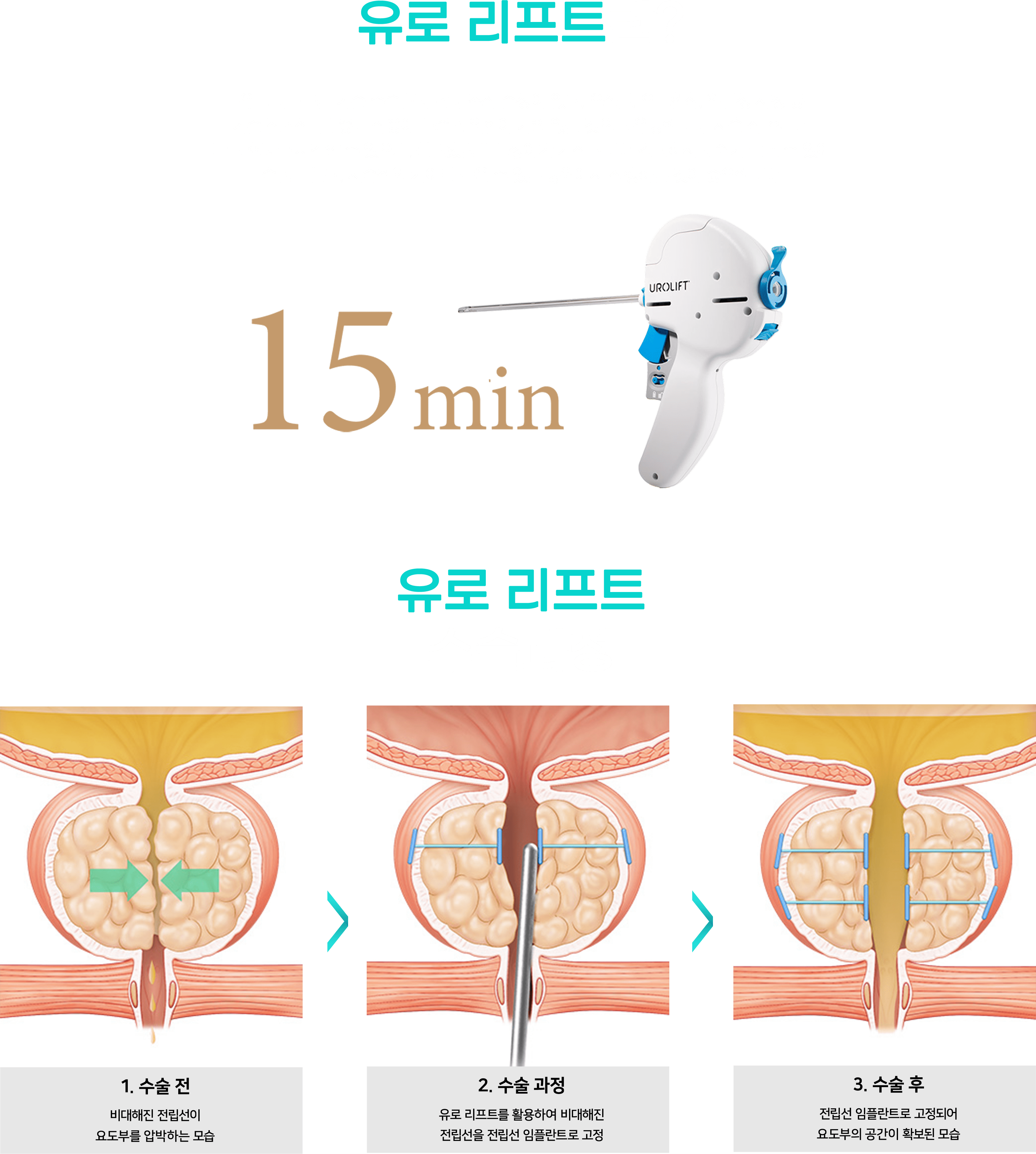 유로리프트